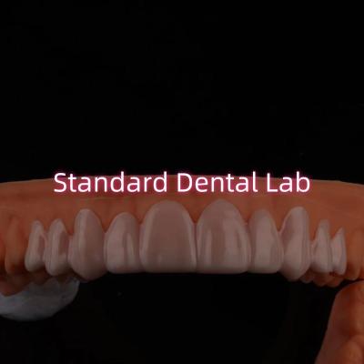 China Dental Snap On Smile Veneers For Teeth Discolorations / Gaps for sale