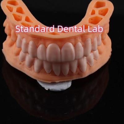 China OEM ODM Pop On Veneers Maßgeschneiderte Veneers Snap On Smile zu verkaufen