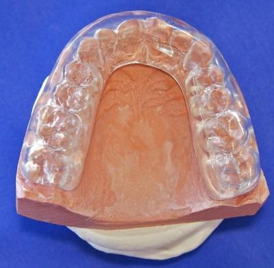 China Semi Hard Soft Occlusal Mouth Guard Dental Comfortable FDA Certified for sale