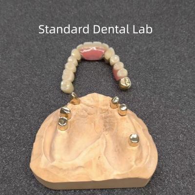 Cina CAD CAM Dente Partiale Protezione dentale Attachment Dental Professional Accurate in vendita