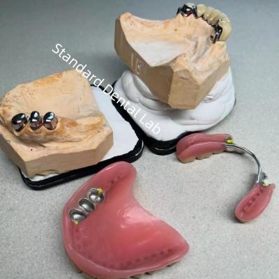 China High Esthetics CAD CAM Tooth Partial Denture Attachment Replacement Standard Dental Lab for sale