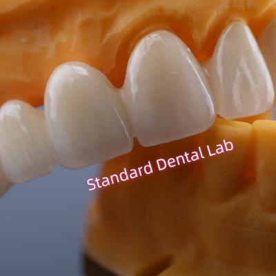 중국 CAD CAM 밀 Zirconia Crown Bridge 고도로 생물 호환성 판매용