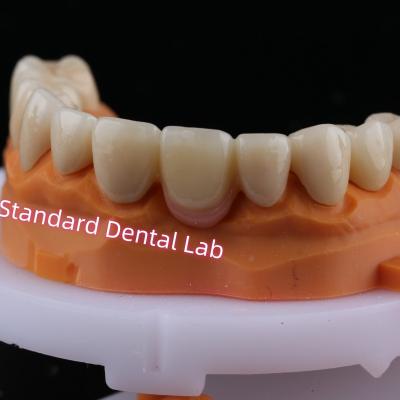 China Digitale CAD CAM freeslaag Zirconia brugkroon met roze porselein Te koop