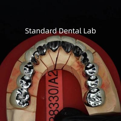 China Coronas de porcelana de metal de arco completo / puente de corona dental PFM estética precisa en venta