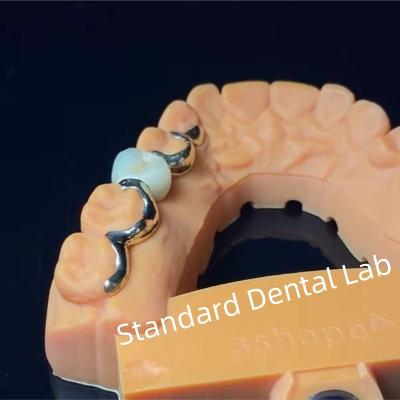 China Dientes dentales PFM Puente de Maryland Alta estética Certificado FDA en venta