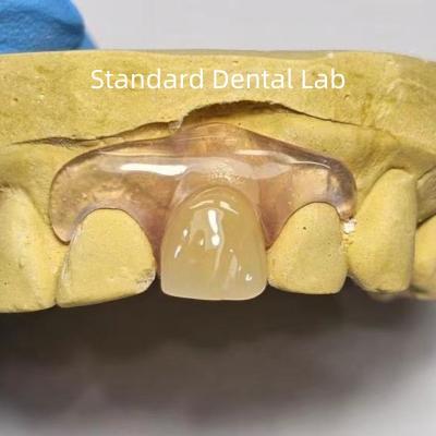 China Dental TCS Valplast Flexible Teilpräparate Farbgebung Verwischungsgerüche widerstandsfähig zu verkaufen