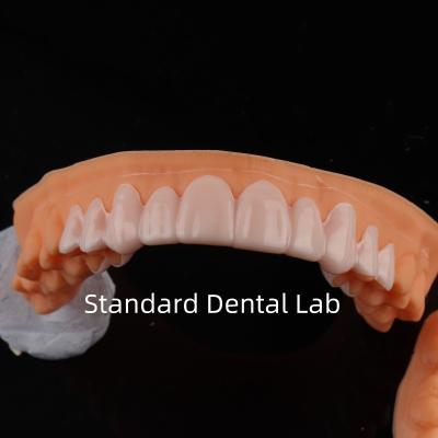 China High Esthetics Dental Snap On Smile Standard Zahnlabor zu verkaufen