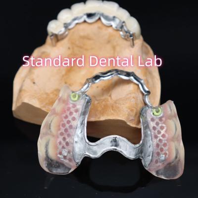 China Removable Precision Attachment New Ace Valplast Partial Denture Pink / Dark for sale