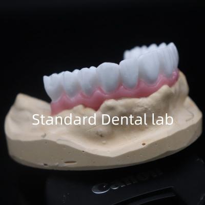 China Alta estética corona dental blanca de diagnóstico de cera personalizada China laboratorio dental en venta