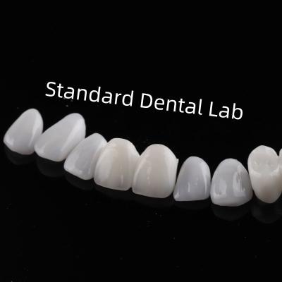 China Dentes de alta estética Emax Veneers laminados Translucidez incisiva à venda