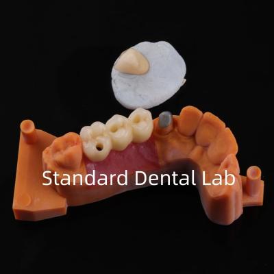 China High Esthetics Core Build Up And Crown Dental Lab Crowns Bridge Good Fit for sale