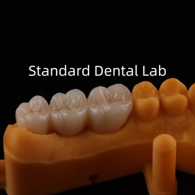 China Coroas de porcelana de metal Be Ni Precise Estética PFM Coroa Dental à venda