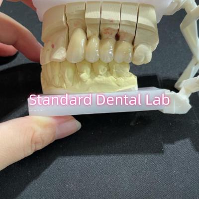 Cina Fuso PFM Non Precious CoCr Metal Porcellana Bridge Dental CCM in vendita