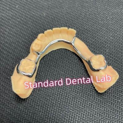 China Dental Bilateral Space Maintainer For Missing Teeth Lingual Holding Arch for sale