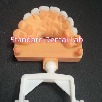 Cina Laminato di zirconia Emax di aspetto naturale in vendita