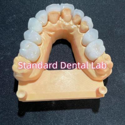 China High Esthetic Hollywood Smile Milling Emax Laminate Veneers for sale