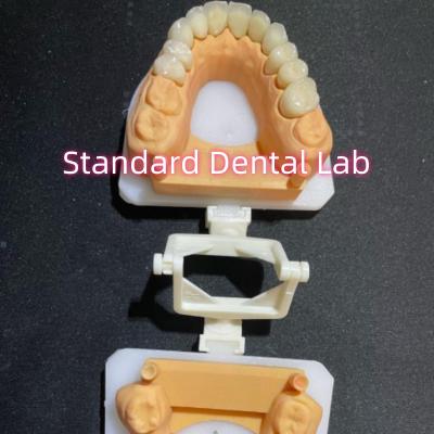 China Dentista Restaurador Odontología Cuidado Oral Corona completa de zirconia personalizada en venta