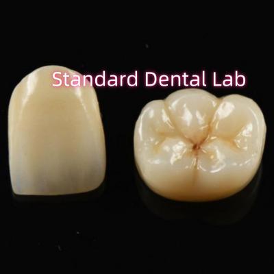 China Biocompatible Material Aesthetic Zirconia Crown Zirconia Bridge Teeth for sale