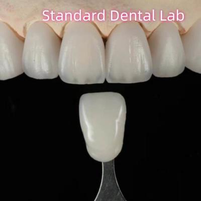 China Puente dental de zirconia de ayuda natural de alta estética personalizada en venta