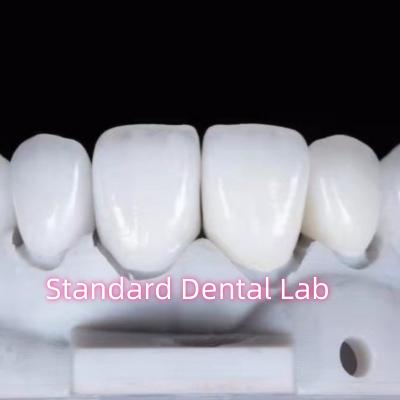 China Restauración de apariencia natural con ayuda dental de zirconia corona dental en venta