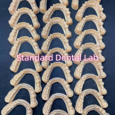 China Professionelle Zahnärztliche Orthodontie Invisalign Klarhalter Behandlungsplan zu verkaufen