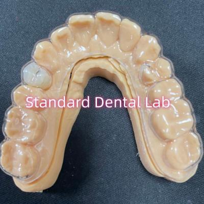 China Professional Orthodontic Retainer Clear Essix Retainers With Stable Acrylic Resin Teeth for sale