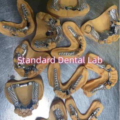 China Dentes parciais de estrutura metálica fundida de cobalto-cromo removível à venda