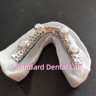 China Cuadro metálico de cobalto cromo fundido Dentadura parcial con marco metálico en venta