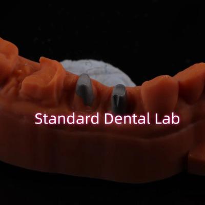 Cina Corone post-core in metallo CAD CAM Porcellana / zirconia coping corone bruxier in zirconia completa in vendita