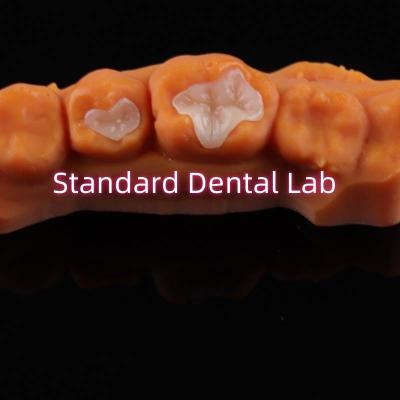 Cina Dental Porcellana Inlay Onlay Overlay Zirconia Emax Composite per le carie dentali in vendita