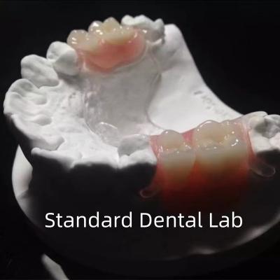 China Estrutura de metal fundido transparente flexível Dentes parciais Alta estética Perfeito ajuste à venda