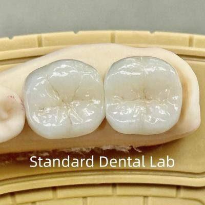 China Coronas de laboratorio dentales translúcidas de contorno completo de zircón con una resistencia superior en venta