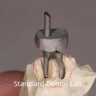 China Restauração Dental Post Metal e Core Crown Perfeito Ajuste à venda