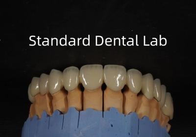 China China Dental Lab Metal Coroa Cerâmica PFM Coroa Alta Estética à venda