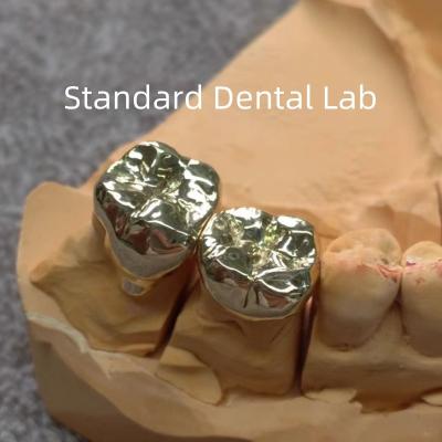 China Coronas de oro dentales amarillas de alto Nobel Profesional Ni Be Free ISO aprobado en venta