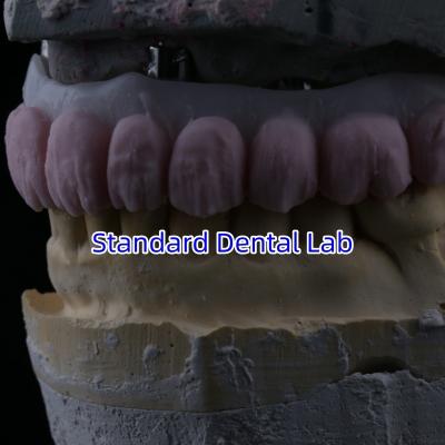 China Porcelain All On Four Zirconia Bridge High Esthetics Dental Implant Bridge for sale