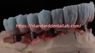 China Implant Supported Zirconia Bridge With Titanium Abutment High Esthetics for sale