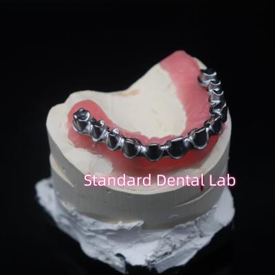 Cina Full Arch Malo Bridge Restauro dentale Coroe di zirconia con gomma Poecelian China Dental Lab in vendita