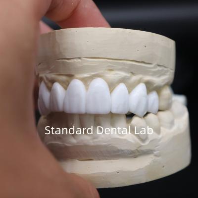 China Dental crowns diagnostic wax-up High Esthetics From China Dental Lab en venta