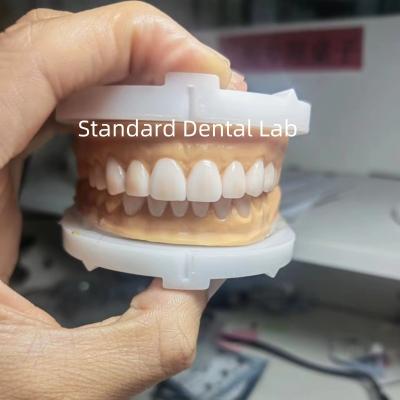 China Perfecte esthetiek Voorlopige was voor tandartsen die tandwas gebruiken van China Dental Lab Te koop