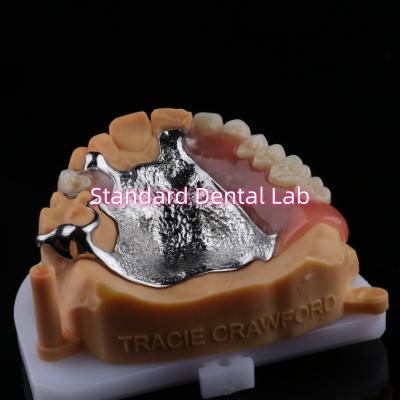 China Quadro superior fundido Dentes parciais de metal acrílico Forte leve e durável à venda