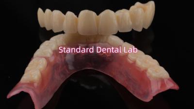 China Highly Durable And Natural-Looking Layered Porcelain For Layered Dental Zirconia Crown China Dental Lab for sale