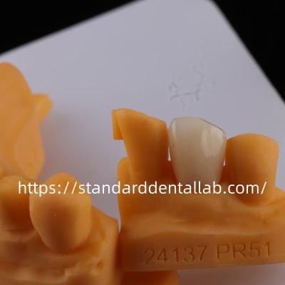 China Volledige contour tandheelkundige lab kronen hoge doorzichtigheid solide zirconia kroon China tandheelkundige lab Te koop