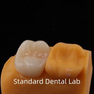 China Get the Best Full Contour Zirconia Crown from a Trusted Dental Laboratory in China Molar Teeth for sale