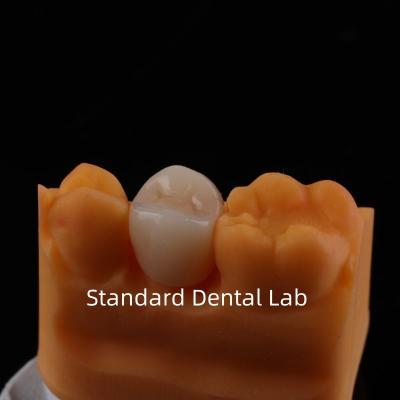 China Full Contour Zirconia Crown Exceptional Strength and Esthetics No Porcelian Overlay Posterior Crown China Dental Lab for sale