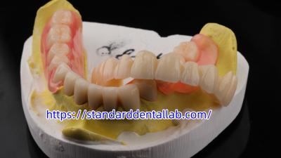 China Alta estética Dental TCS Valplast Flexible Dentaduras parciales Dental Laboratorio Valplast Cerradura Tinta rosa en venta