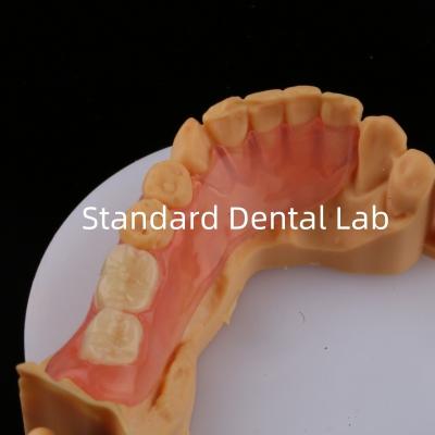 Chine Les dents d'as sont de couleur rose/obscur TCS Valplast Prothèses partielles flexibles pour une esthétique élevée Modèle d'impression 3D dentaire à vendre