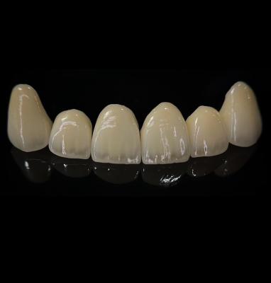 China Comfortable Zirconia Crown With Good Fitting And Precision Esthetics for sale