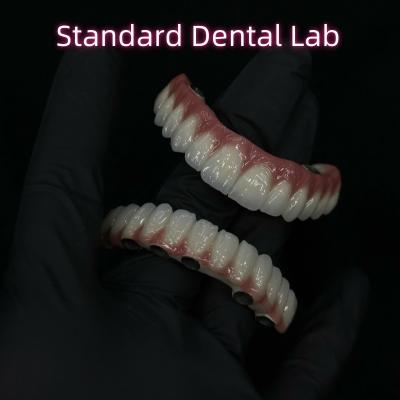 China Implantes dentales de titanio de zirconia todos en 4 dientes de arco completo reemplazo 3-6 meses tiempo de curación en venta