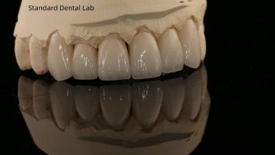 China Volledige contour Zirconia kroon en hoge esthetiek natuurlijke gebit brug 5 jaar garantie Te koop